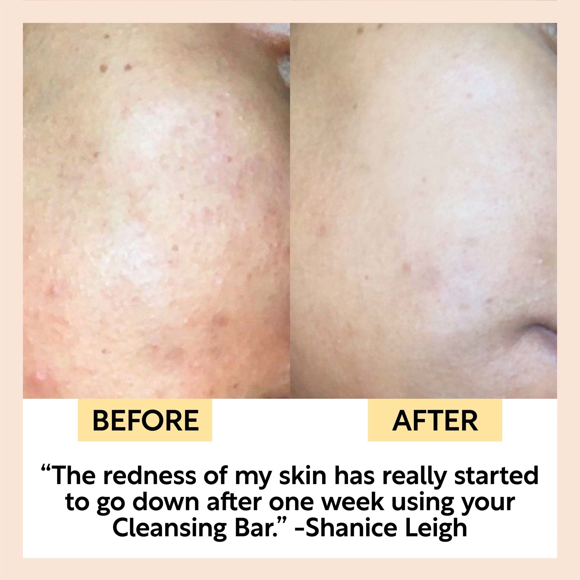 Chai Soap Cleansing Duo