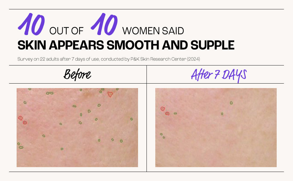 Retinal Resurfacing Sheet Mask 5-Pack Box