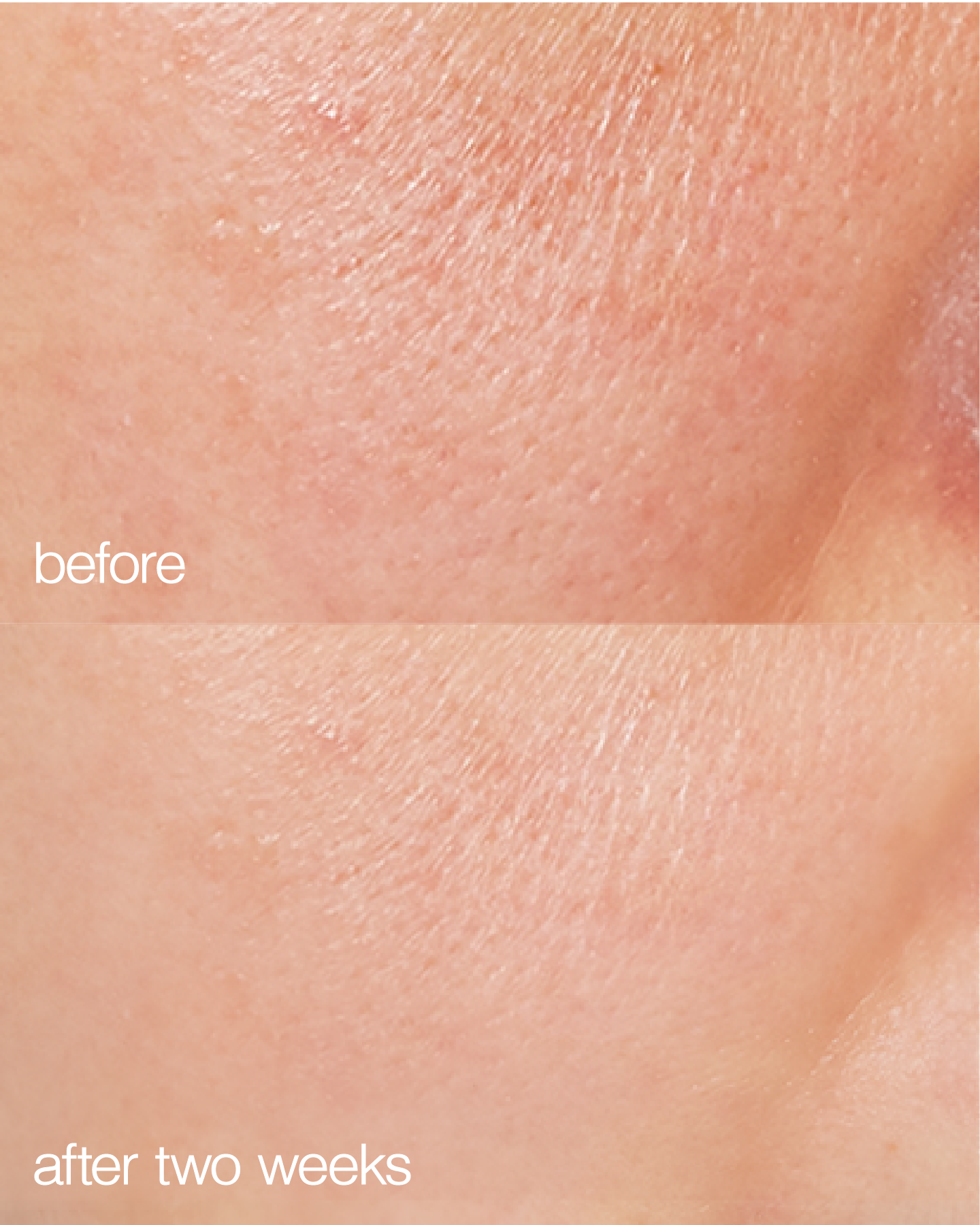 Biome Boost Cream Daily Moisturizer