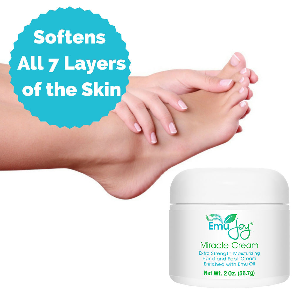 Miracle Cream (f.k.a., Banish My Callus)