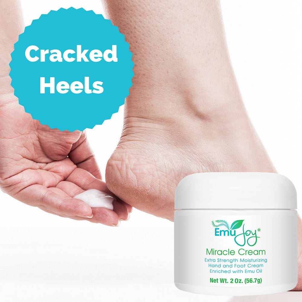 Miracle Cream (f.k.a., Banish My Callus)