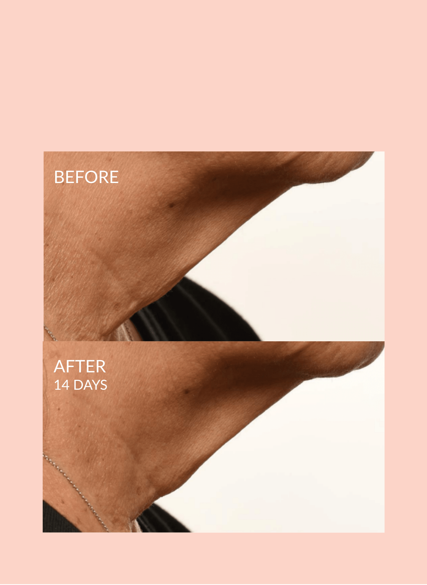 Triple Lift Molecule Mask